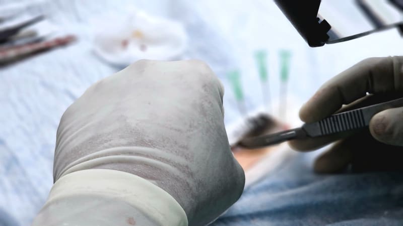 A resurfacing handpiece worked across the skin during a facial